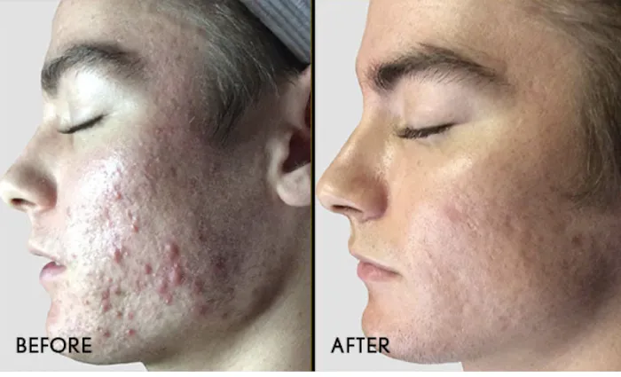 Samara Esthetics San Diego Picture 10