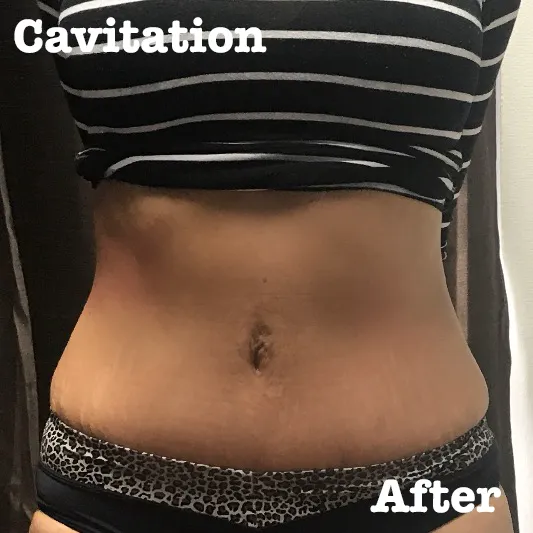 San Diego Molding Studio Skin Care Picture 4