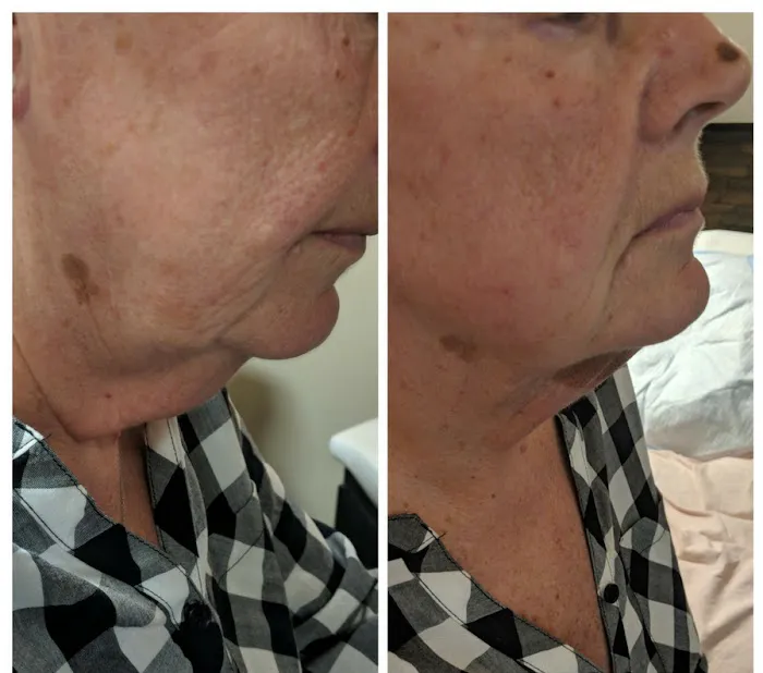 Dermaluxe Skin Studio Picture 5