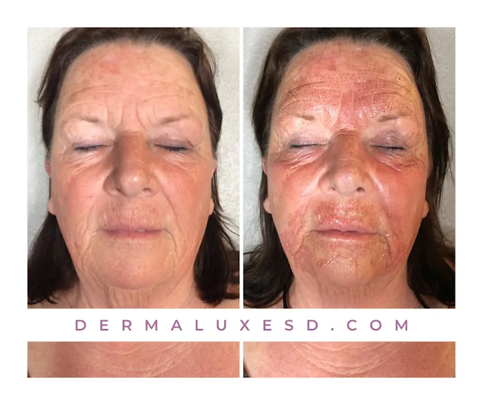 Dermaluxe Skin Studio Picture 9