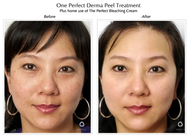 Confident Complexion Skin Care Picture 7