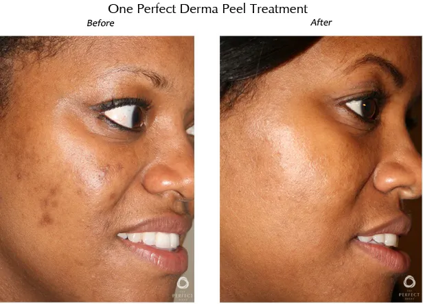 Confident Complexion Skin Care Picture 2