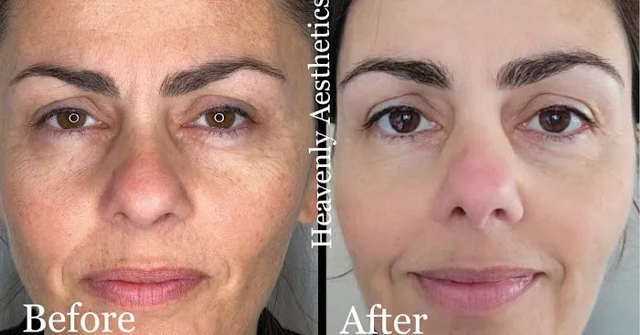 Heavenly Aesthetics Picture 3