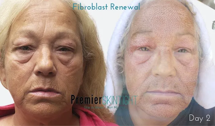 Premier Skintight Studios LLC Picture 6