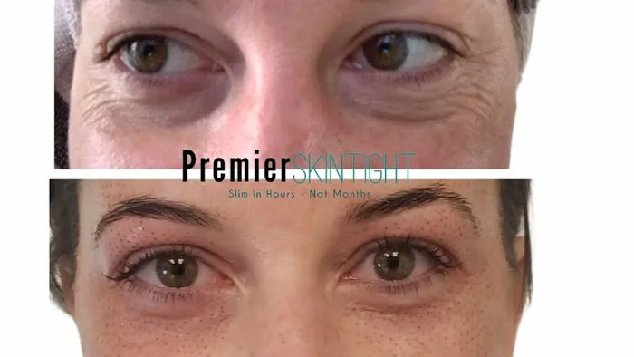 Premier Skintight Studios LLC Picture 2