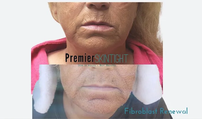 Premier Skintight Studios LLC Picture 8