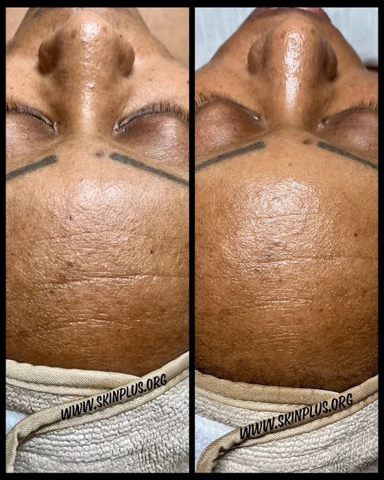 Skin Plus by Maja Vukmanic Hicks Picture 1