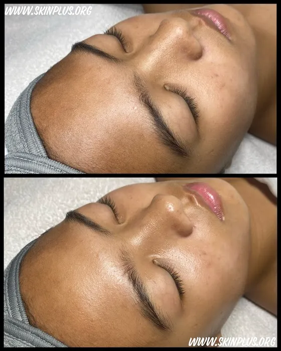 Skin Plus by Maja Vukmanic Hicks Picture 10