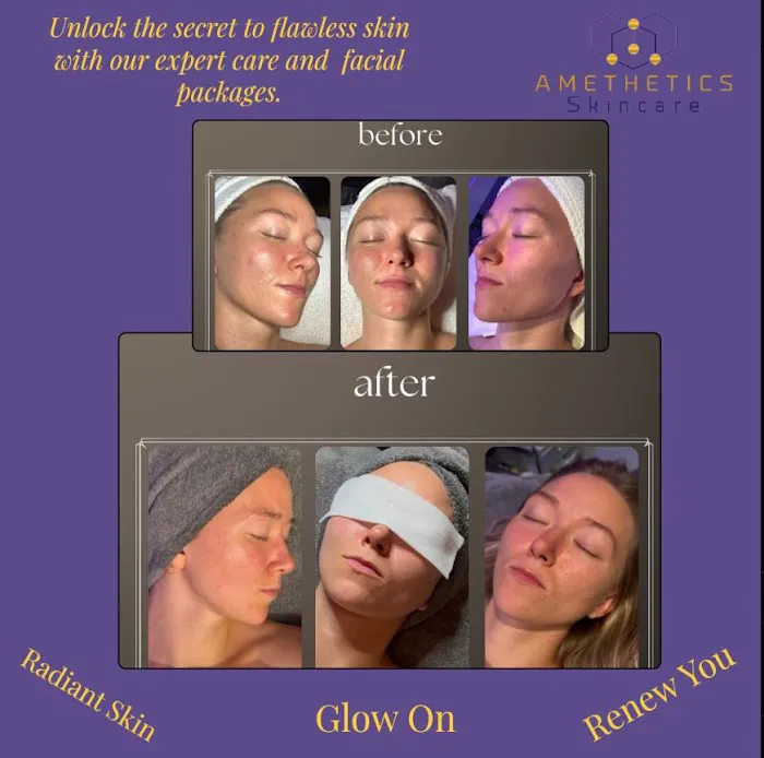 Amethetics Skincare Picture 7