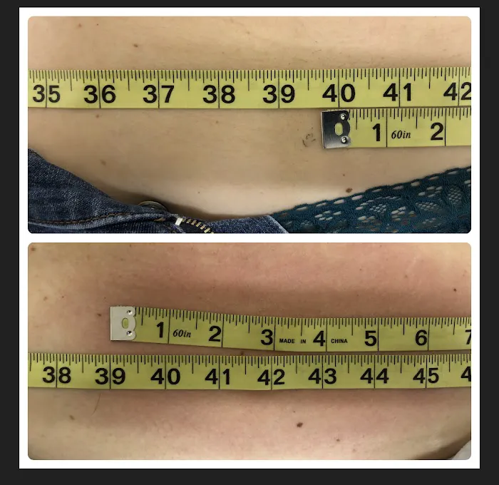 cryo sculpting lab Picture 10