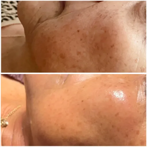 The Skyn Bar Picture 3