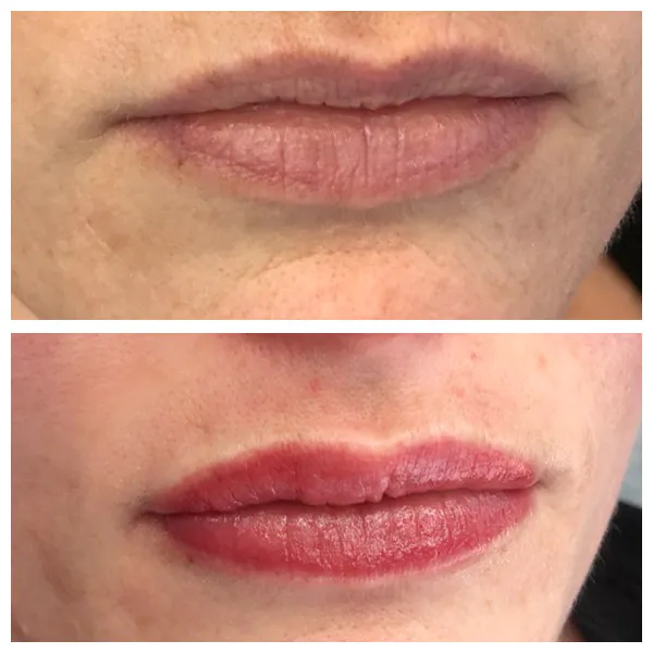 The Skyn Bar Picture 2