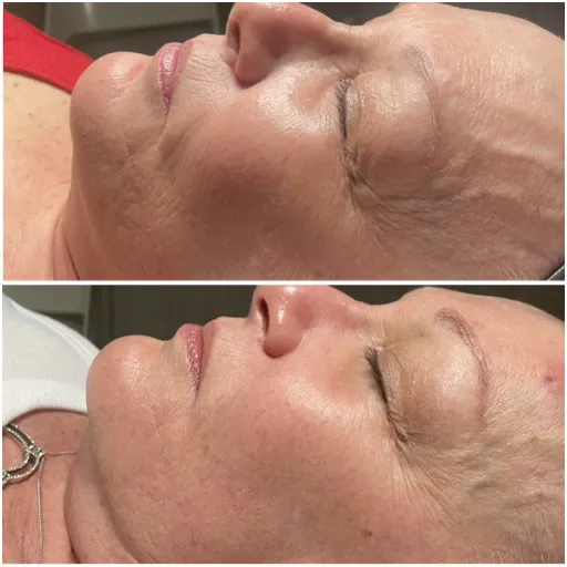 The Skyn Bar Picture 5