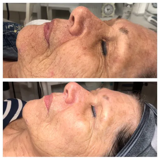 The Skyn Bar Picture 6