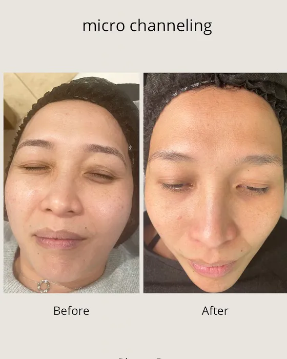 Phure Beauty - Wellness Skin Bar Picture 4