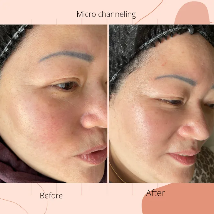 Phure Beauty - Wellness Skin Bar Picture 10