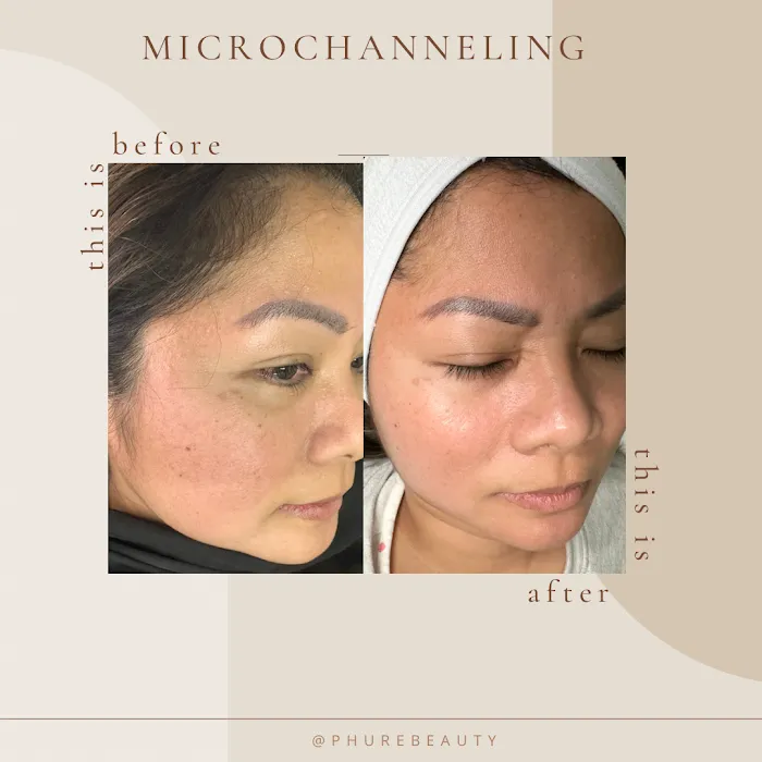 Phure Beauty - Wellness Skin Bar Picture 7