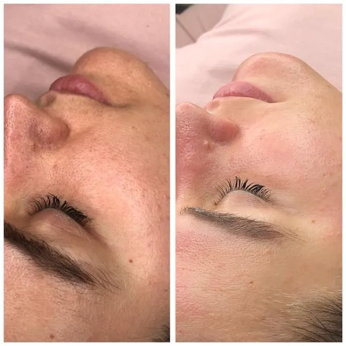 PURskin Clinical Picture 9