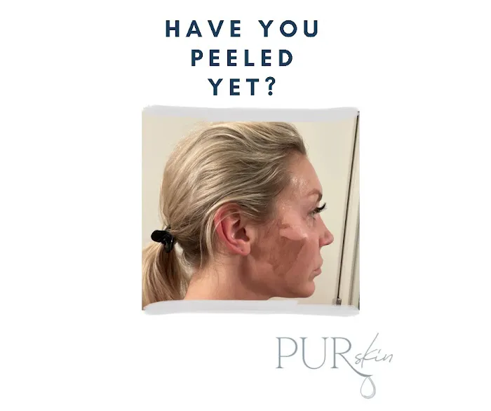 PURskin Clinical Picture 2