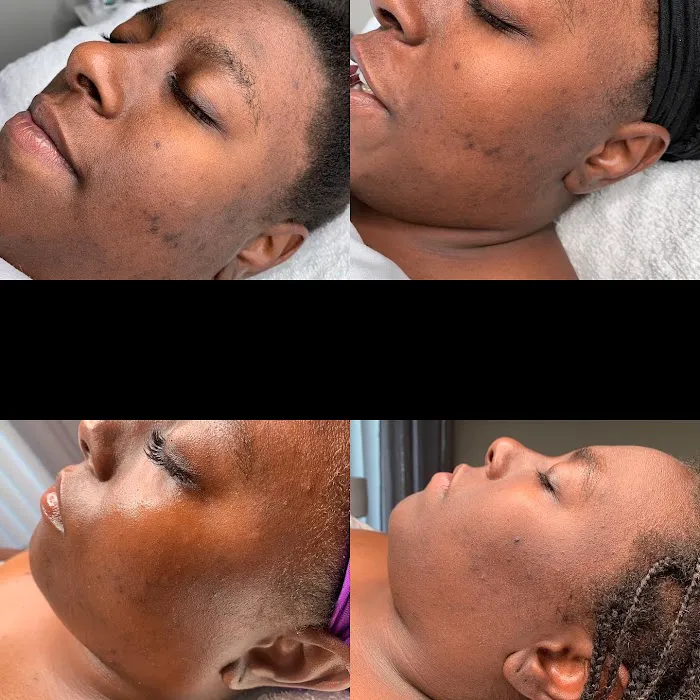 Glow Skintique Picture 8