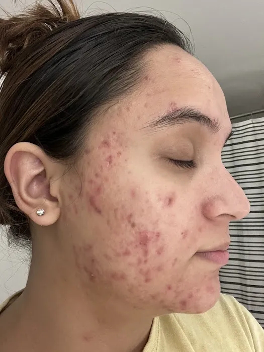 Rose + Honey Skincare Picture 2