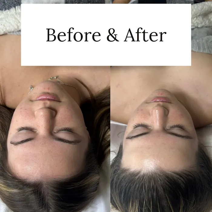 Aly Does Esthetics Picture 10