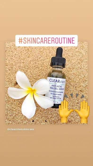 San Diego Acne Clinic Picture 6