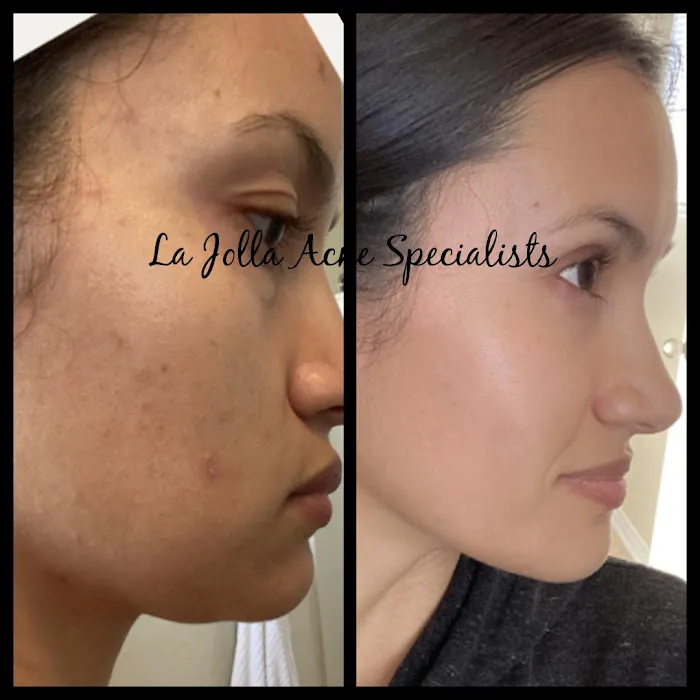 La Jolla Acne Specialists Picture 8