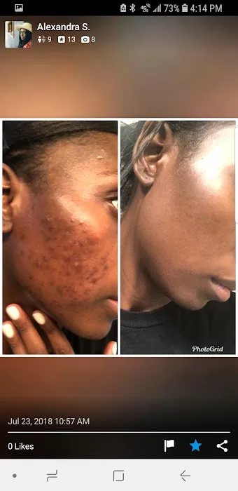 La Jolla Acne Specialists Picture 6