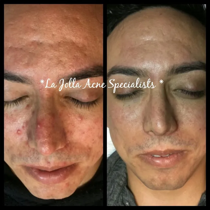 La Jolla Acne Specialists Picture 3