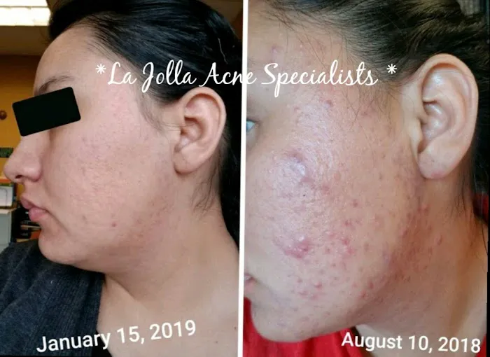 La Jolla Acne Specialists Picture 9