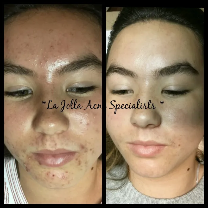 La Jolla Acne Specialists Picture 10