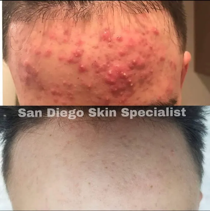 San Diego Skin and Acne Specialist Picture 2