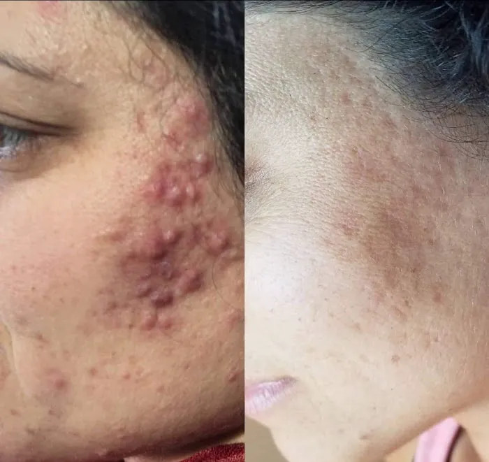 San Diego Skin and Acne Specialist Picture 3