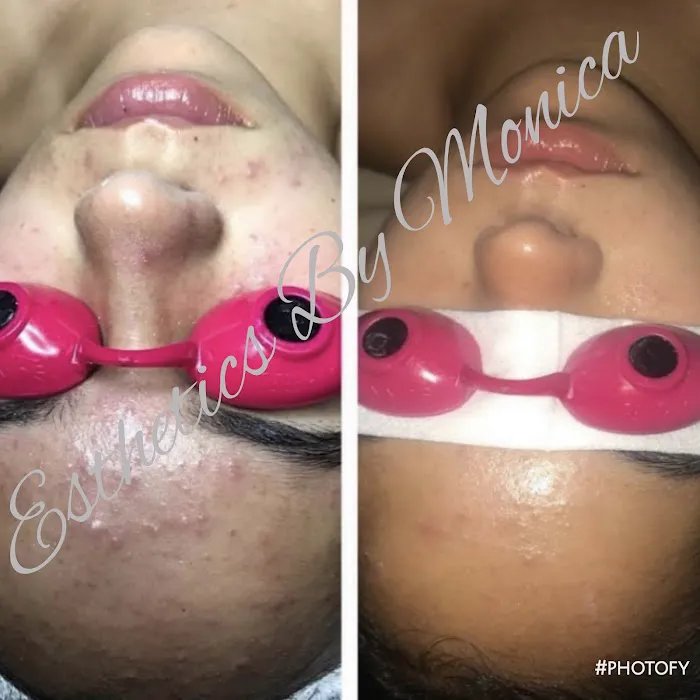 Esthetics By Monica Picture 5