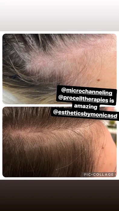 Esthetics By Monica Picture 6