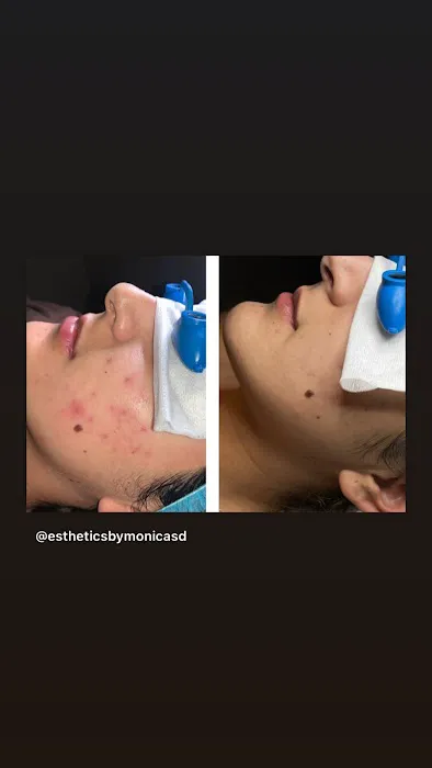 Esthetics By Monica Picture 7