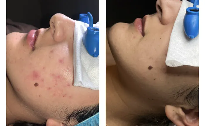 Esthetics By Monica Picture 3