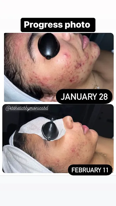 Esthetics By Monica Picture 2