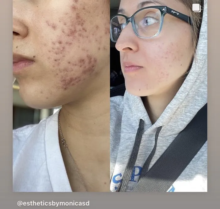 Esthetics By Monica Picture 10