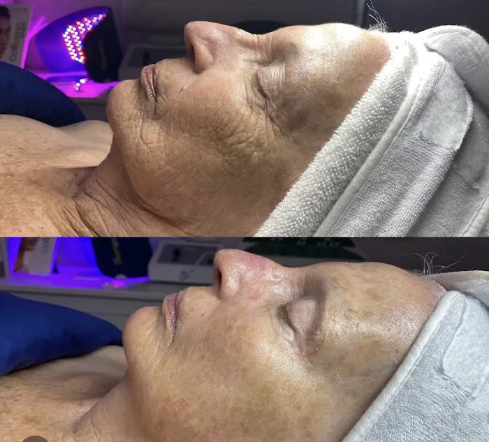 Signature Skin Care By Denise Ann Picture 6