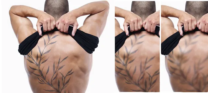 Umansky Laser and Skin Center Picture 1