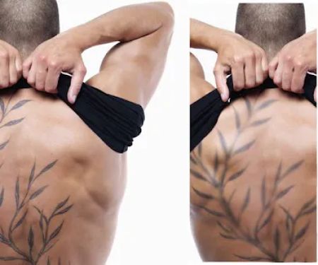 Umansky Laser and Skin Center