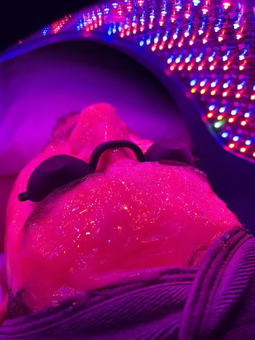 Healthy Skin Club Picture 5