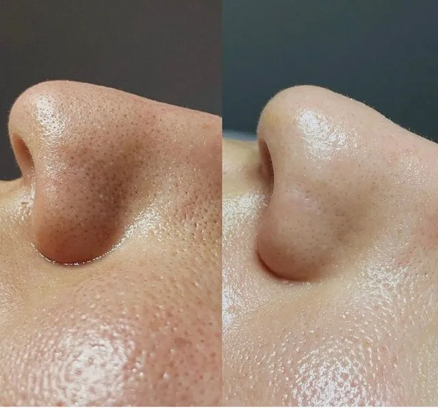 Skintique Del Mar Picture 8