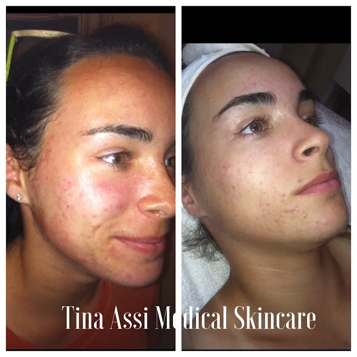 Skin & Brows by Tina Picture 7