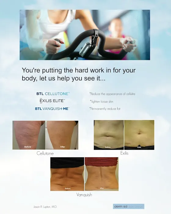 San Diego Dermatology and Laser Surgery Picture 7