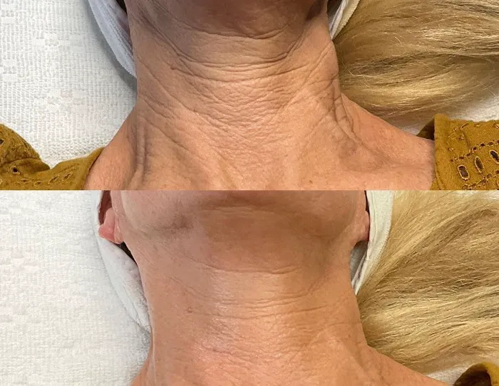 Ashley Sigdestad - Esthetician Picture 1