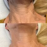 Ashley Sigdestad - Esthetician