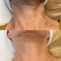 Ashley Sigdestad - Esthetician ico